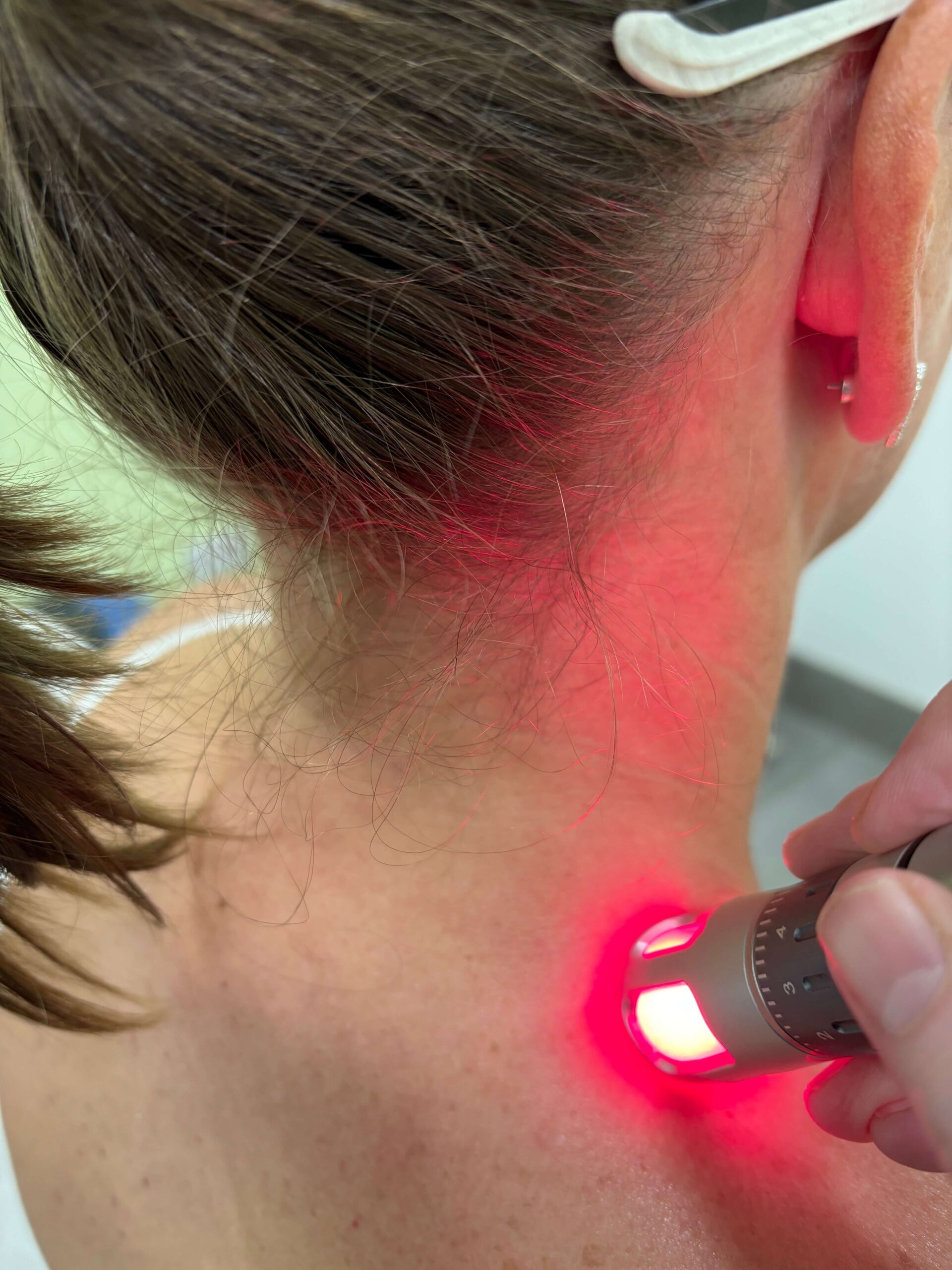 woman's back getting shockwave treatment